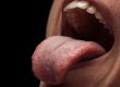 granos en la lengua